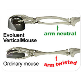 Evoluent Verticalmouse 4 Small Wireless Mouse